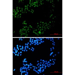 Invitrogen CRTC3 Recombinant Rabbit Monoclonal Antibody (K01_1L06) 50 &mu;L | Buy Online | Invitrogen&trade; | Fisher Scientific