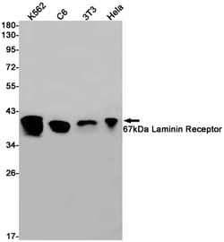 Invitrogen RPSA Recombinant Rabbit Monoclonal Antibody (K01_1M23) 100 &mu;L | Buy Online | Invitrogen&trade; | Fisher Scientific