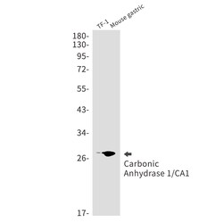 Invitrogen Carbonic Anhydrase I Recombinant Rabbit Monoclonal Antibody (K01_1N84) 100 &mu;L | Buy Online | Invitrogen&trade; | Fisher Scientific