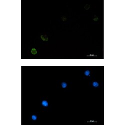 Invitrogen c-Cbl Recombinant Rabbit Monoclonal Antibody (K01_1P01) 100 &mu;L | Buy Online | Invitrogen&trade; | Fisher Scientific