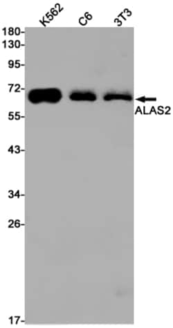 Invitrogen ALAS2 Recombinant Rabbit Monoclonal Antibody (K01_1M51) 50 &mu;L;