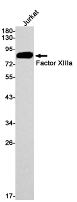 Invitrogen Factor XIII Recombinant Rabbit Monoclonal Antibody (K01_1K61):Antibodies:Primary