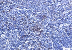 Invitrogen CD8a Recombinant Rabbit Monoclonal Antibody (K01_1L87) 50 &mu;L | Buy Online | Invitrogen&trade; | Fisher Scientific