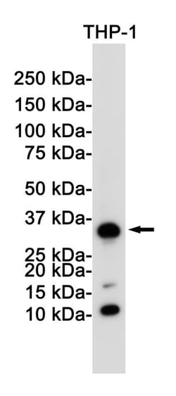 Invitrogen CD8a Recombinant Rabbit Monoclonal Antibody (K01_1L87) 50 &mu;L | Buy Online | Invitrogen&trade; | Fisher Scientific