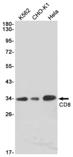 Invitrogen CD8a Recombinant Rabbit Monoclonal Antibody (K01_1L87) 50 &mu;L | Buy Online | Invitrogen&trade; | Fisher Scientific