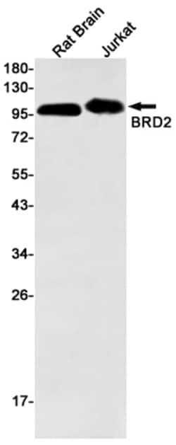 Invitrogen BRD2 Recombinant Rabbit Monoclonal Antibody (K01_1N67) 50 &mu;L | Buy Online | Invitrogen&trade; | Fisher Scientific