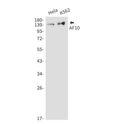 Invitrogen MLLT10 Recombinant Rabbit Monoclonal Antibody (K01_1M47) 100 &mu;L | Buy Online | Invitrogen&trade; | Fisher Scientific