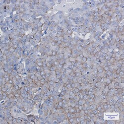 Invitrogen BTF3 Recombinant Rabbit Monoclonal Antibody (K01_1N69) 100 &mu;L | Buy Online | Invitrogen&trade; | Fisher Scientific