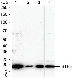 Invitrogen BTF3 Recombinant Rabbit Monoclonal Antibody (K01_1N69) 100 &mu;L | Buy Online | Invitrogen&trade; | Fisher Scientific