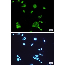 Invitrogen PGD Recombinant Rabbit Monoclonal Antibody (K01_1K97) 100 &mu;L | Buy Online | Invitrogen&trade; | Fisher Scientific
