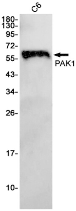 Invitrogen PAK1 Recombinant Rabbit Monoclonal Antibody (K01_1W34) 100 &mu;L | Buy Online | Invitrogen&trade; | Fisher Scientific