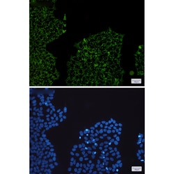 Invitrogen HADHA Recombinant Rabbit Monoclonal Antibody (K01_1S01) 50 &mu;L | Buy Online | Invitrogen&trade; | Fisher Scientific