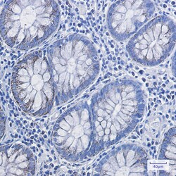 Invitrogen HADHA Recombinant Rabbit Monoclonal Antibody (K01_1S01) 50 &mu;L | Buy Online | Invitrogen&trade; | Fisher Scientific