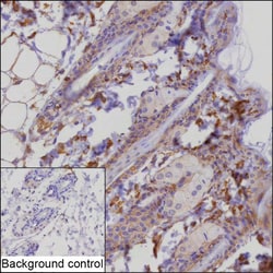 Invitrogen P-cadherin Recombinant Rabbit Monoclonal Antibody (K01_1W36) 100 &mu;L | Buy Online | Invitrogen&trade; | Fisher Scientific