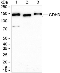 Invitrogen P-cadherin Recombinant Rabbit Monoclonal Antibody (K01_1W36) 100 &mu;L | Buy Online | Invitrogen&trade; | Fisher Scientific