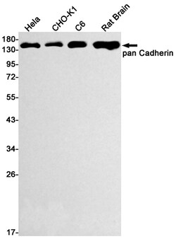Invitrogen P-cadherin Recombinant Rabbit Monoclonal Antibody (K01_1W36) 100 &mu;L | Buy Online | Invitrogen&trade; | Fisher Scientific