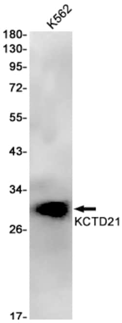 Invitrogen KCTD21 Recombinant Rabbit Monoclonal Antibody (K01_1T21) 50 &mu;L | Buy Online | Invitrogen&trade; | Fisher Scientific