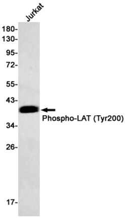 Invitrogen Phospho-LAT (Tyr200) Recombinant Rabbit Monoclonal Antibody (K01_1T41) 100 &mu;L | Buy Online | Invitrogen&trade; | Fisher Scientific