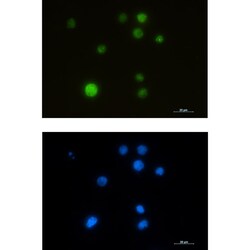 Invitrogen SMARCA5 Recombinant Rabbit Monoclonal Antibody (K01_1Y58) 50 &mu;L | Buy Online | Invitrogen&trade; | Fisher Scientific