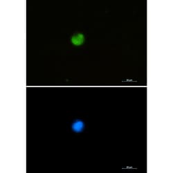 Invitrogen hnRNP M Recombinant Rabbit Monoclonal Antibody (K01_1S41) 100 &mu;L | Buy Online | Invitrogen&trade; | Fisher Scientific
