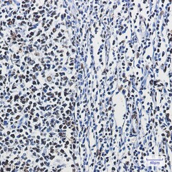 Invitrogen hnRNP M Recombinant Rabbit Monoclonal Antibody (K01_1S41) 100 &mu;L | Buy Online | Invitrogen&trade; | Fisher Scientific