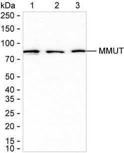 Invitrogen MUT Recombinant Rabbit Monoclonal Antibody (K01_1T85) 50 &mu;L | Buy Online | Invitrogen&trade; | Fisher Scientific