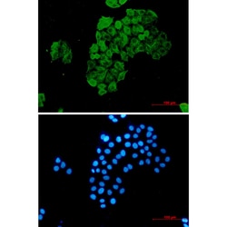 Invitrogen&trade;&nbsp;FKBP4 Recombinant Rabbit Monoclonal Antibody (K01_1R21)