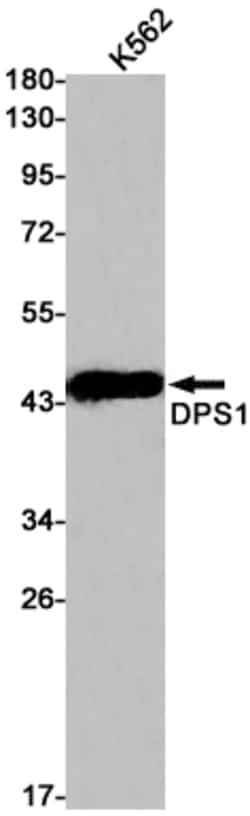 Invitrogen PDSS1 Recombinant Rabbit Monoclonal Antibody (K01_1Q56) 50 &mu;L | Buy Online | Invitrogen&trade; | Fisher Scientific