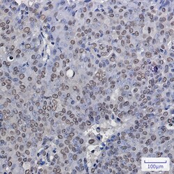 Invitrogen ENT2 Recombinant Rabbit Monoclonal Antibody (K01_1Q82) 100 &mu;L | Buy Online | Invitrogen&trade; | Fisher Scientific