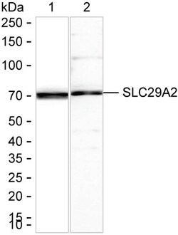 Invitrogen ENT2 Recombinant Rabbit Monoclonal Antibody (K01_1Q82) 100 &mu;L | Buy Online | Invitrogen&trade; | Fisher Scientific