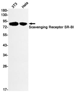 Invitrogen SR-BI Recombinant Rabbit Monoclonal Antibody (K01_1Y14) 50 &mu;L | Buy Online | Invitrogen&trade; | Fisher Scientific