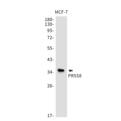 Invitrogen Prostasin Recombinant Rabbit Monoclonal Antibody (K01_1X24) 50 &mu;L | Buy Online | Invitrogen&trade; | Fisher Scientific