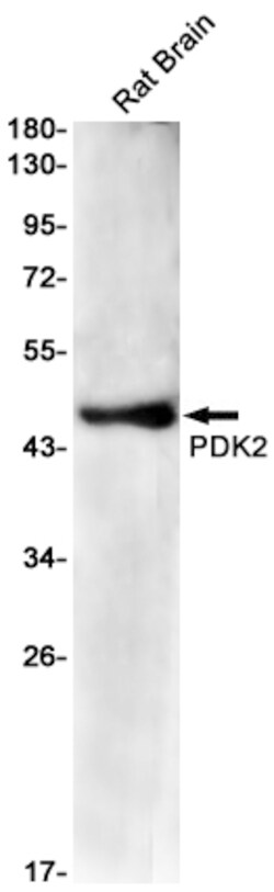 Invitrogen PDK2 Recombinant Rabbit Monoclonal Antibody (K01_1W51) 100 &mu;L | Buy Online | Invitrogen&trade; | Fisher Scientific