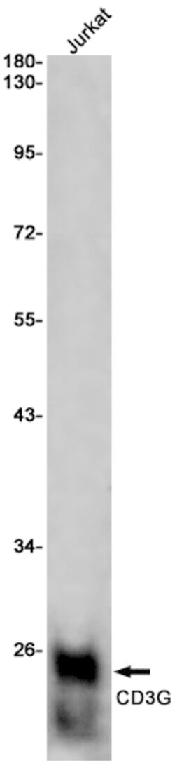 Invitrogen CD3g Recombinant Rabbit Monoclonal Antibody (K01_1P24) 50 &mu;L | Buy Online | Invitrogen&trade; | Fisher Scientific