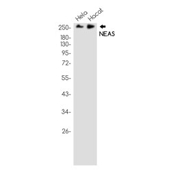Invitrogen SPTAN1 Recombinant Rabbit Monoclonal Antibody (K01_1U61) 100 &mu;L | Buy Online | Invitrogen&trade; | Fisher Scientific