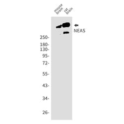 Invitrogen SPTAN1 Recombinant Rabbit Monoclonal Antibody (K01_1U61) 100 &mu;L | Buy Online | Invitrogen&trade; | Fisher Scientific