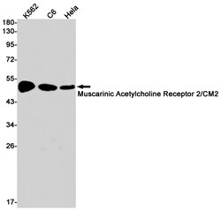 Invitrogen CHRM2 Recombinant Rabbit Monoclonal Antibody (K01_1U25) 50 &mu;L;