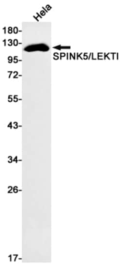 Invitrogen SPINK5 Recombinant Rabbit Monoclonal Antibody (K01_1Y69) 50 &mu;L | Buy Online | Invitrogen&trade; | Fisher Scientific