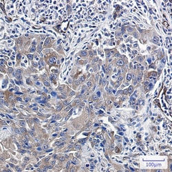 Invitrogen Radixin Recombinant Rabbit Monoclonal Antibody (K01_1X51) 50 &mu;L | Buy Online | Invitrogen&trade; | Fisher Scientific