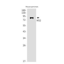 Invitrogen ADAM8 Recombinant Rabbit Monoclonal Antibody (K01_1U09) 50 &mu;L | Buy Online | Invitrogen&trade; | Fisher Scientific