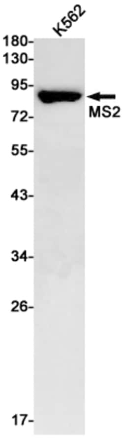 Invitrogen ADAM8 Recombinant Rabbit Monoclonal Antibody (K01_1U09) 50 &mu;L | Buy Online | Invitrogen&trade; | Fisher Scientific