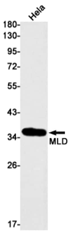 Invitrogen™ DEGS1 Recombinant Rabbit Monoclonal Antibody (K01_1T94)