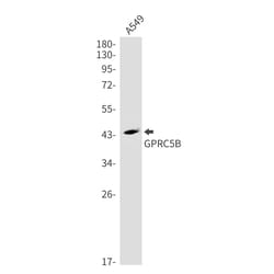 Invitrogen GPRC5B Recombinant Rabbit Monoclonal Antibody (K01_1R93) 50 &mu;L | Buy Online | Invitrogen&trade; | Fisher Scientific