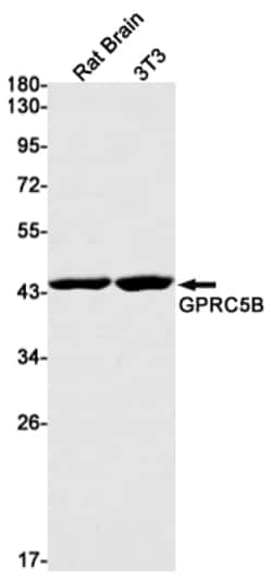Invitrogen GPRC5B Recombinant Rabbit Monoclonal Antibody (K01_1R93) 50 &mu;L | Buy Online | Invitrogen&trade; | Fisher Scientific