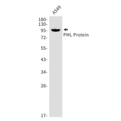 Invitrogen PML Recombinant Rabbit Monoclonal Antibody (K01_1W91) 100 &mu;L | Buy Online | Invitrogen&trade; | Fisher Scientific