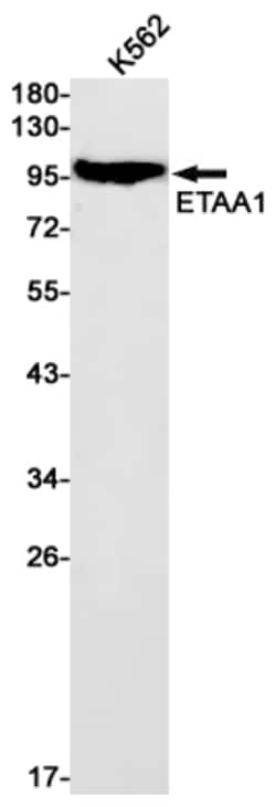 Invitrogen ETAA1 Recombinant Rabbit Monoclonal Antibody (K01_1Q92) 50 &mu;L | Buy Online | Invitrogen&trade; | Fisher Scientific