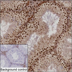 Invitrogen NPM1 Recombinant Rabbit Monoclonal Antibody (K01_1U96) 50 &mu;L;