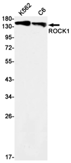 Invitrogen ROCK1 Recombinant Rabbit Monoclonal Antibody (K01_1X84) 50 &mu;L | Buy Online | Invitrogen&trade; | Fisher Scientific