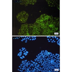Invitrogen RAP1GAP Recombinant Rabbit Monoclonal Antibody (K01_1X60) 100 &mu;L | Buy Online | Invitrogen&trade; | Fisher Scientific