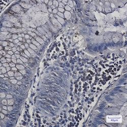 Invitrogen N-WASP Recombinant Rabbit Monoclonal Antibody (K01_1W05) 50